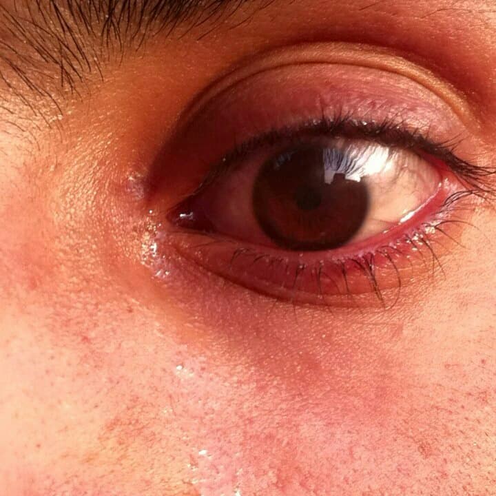 Eye