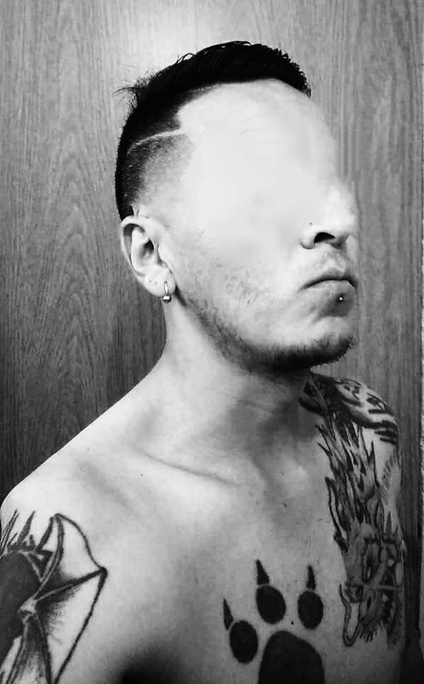 no eyes