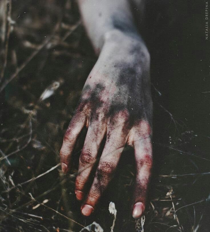 Burden of Pain